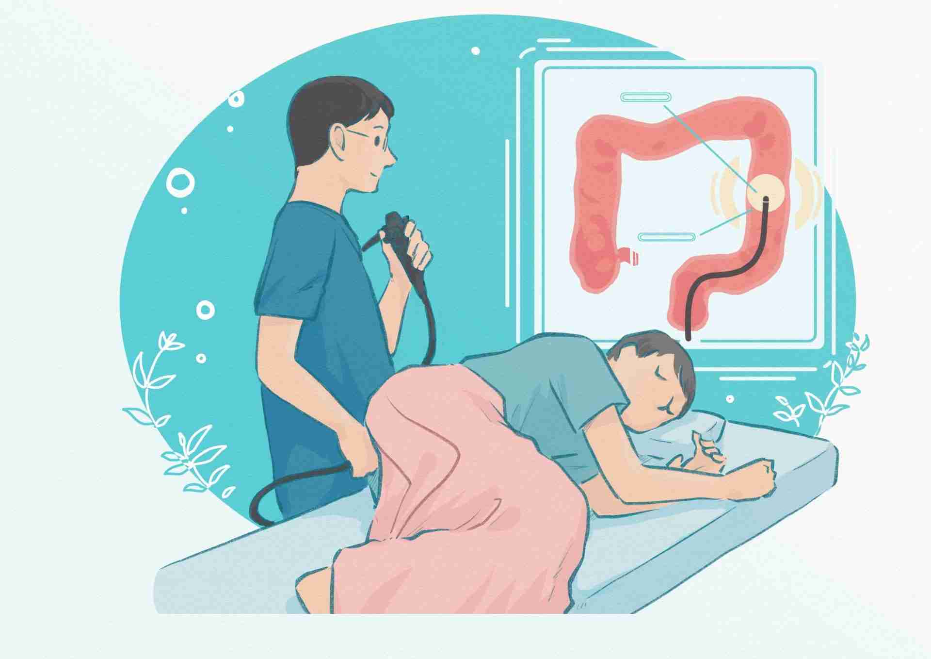 大腸検査が恐い
