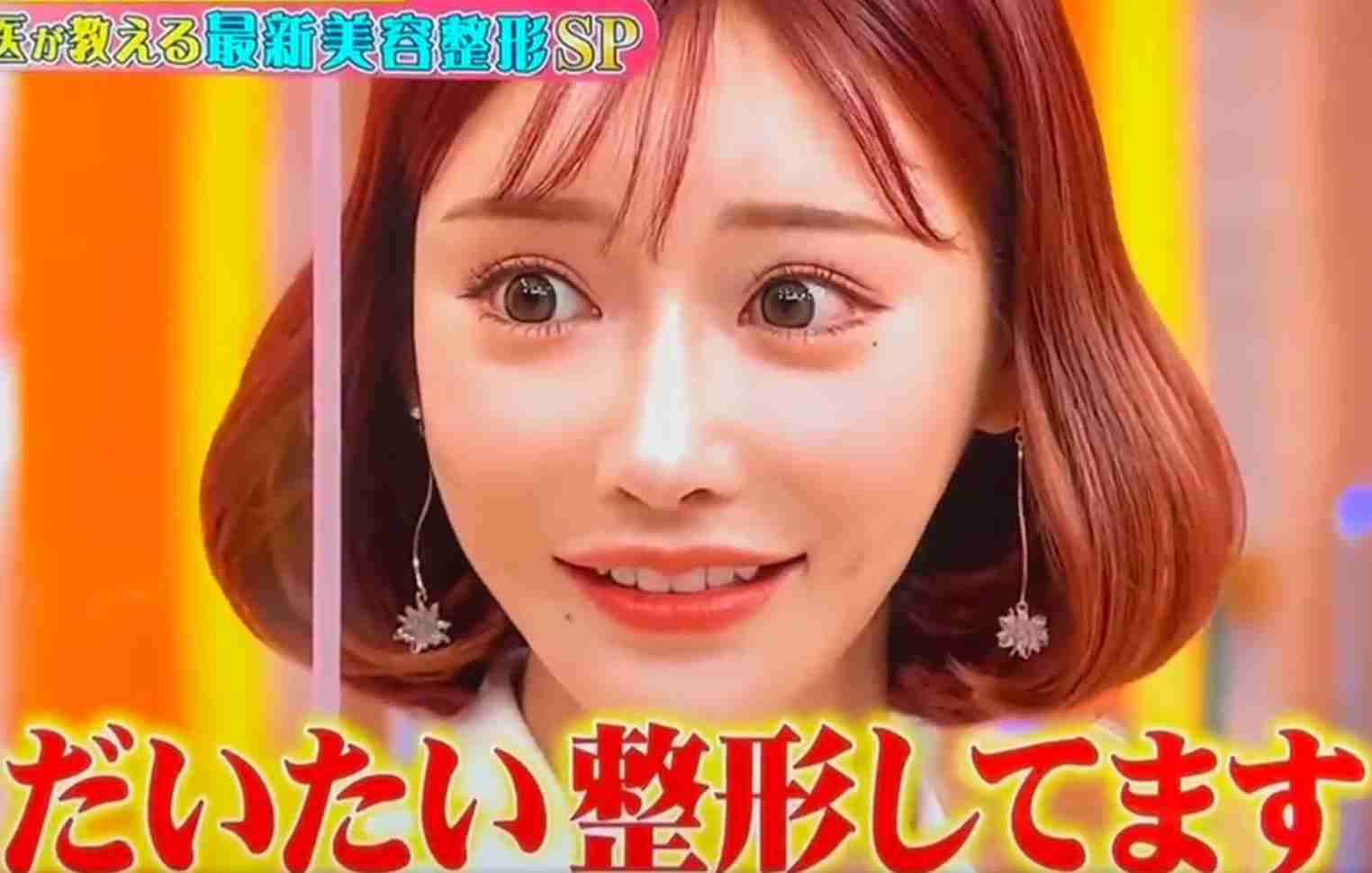 整形を決意した理由