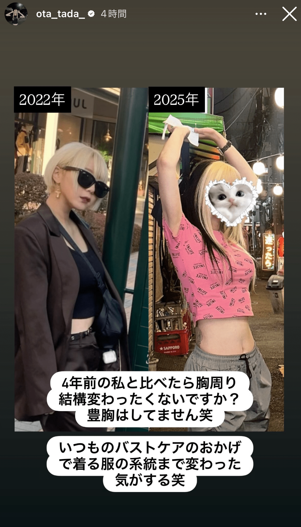 『夜ふかし』多田さん「豊胸はしてません」と断言も“上半身ふっくら”劇的変化　「着る服の系統が変わった」日々の努力