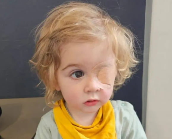 2歳の赤ちゃんがキスを受けた後、悪性菌に感染し、片方の目の視力を失うことが発生した。11日（現地時間）、英メトロによると、ナミビア出身のミシェル·サイマン（36）は昨年8月、当時16ヵ月だった息子ジュ.. - MK