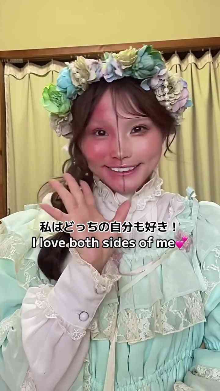 顔の半分が真っ赤に…アトピー姿を公開した女性、幼少期は“汚いもの”として扱われ「人に触れる行為に罪悪感を持っていた」