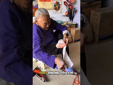 Lotus Feet - A painful Chinese tradition