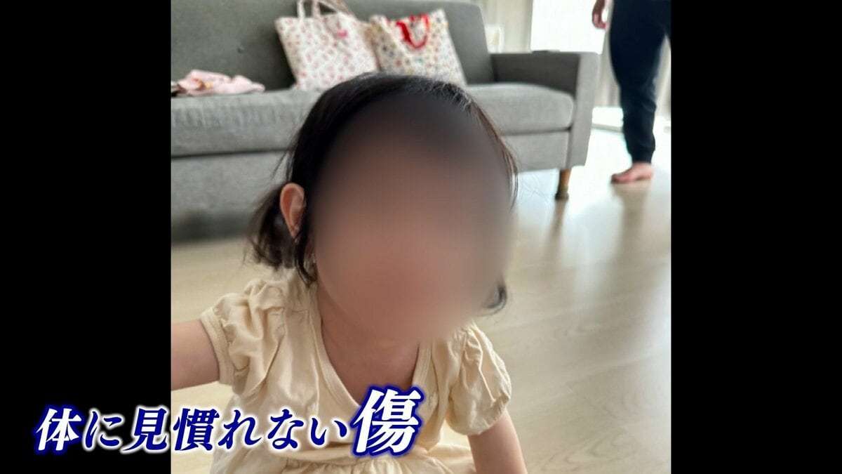 「何回も言うけどくさい」「ご迷惑かけてんのよあんたは」保育士が2歳児に投げた言葉　暴言、暴力認める　発覚のきっかけは”お守りに忍ばせたボイスレコーダー” | TBS NEWS DIG