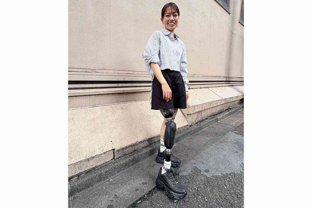「あ、足がない」逆走車と衝突、理不尽に失った右脚　「絶対に看護師に戻る」奇跡の復活　「苦しみながらでも…」 不屈の人生