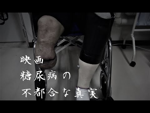 糖尿病の不都合な真実 【映画】