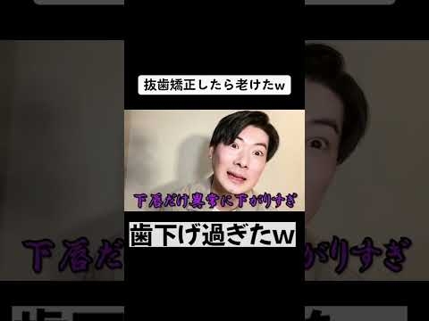 抜歯矯正したら老けたｗ #矯正日記  #歯列矯正 #口ゴボ #出っ歯 #eライン #アンカースクリュー