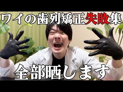歯列矯正で失敗された６点晒す
