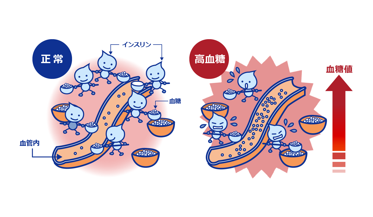 糖尿病について知っていること