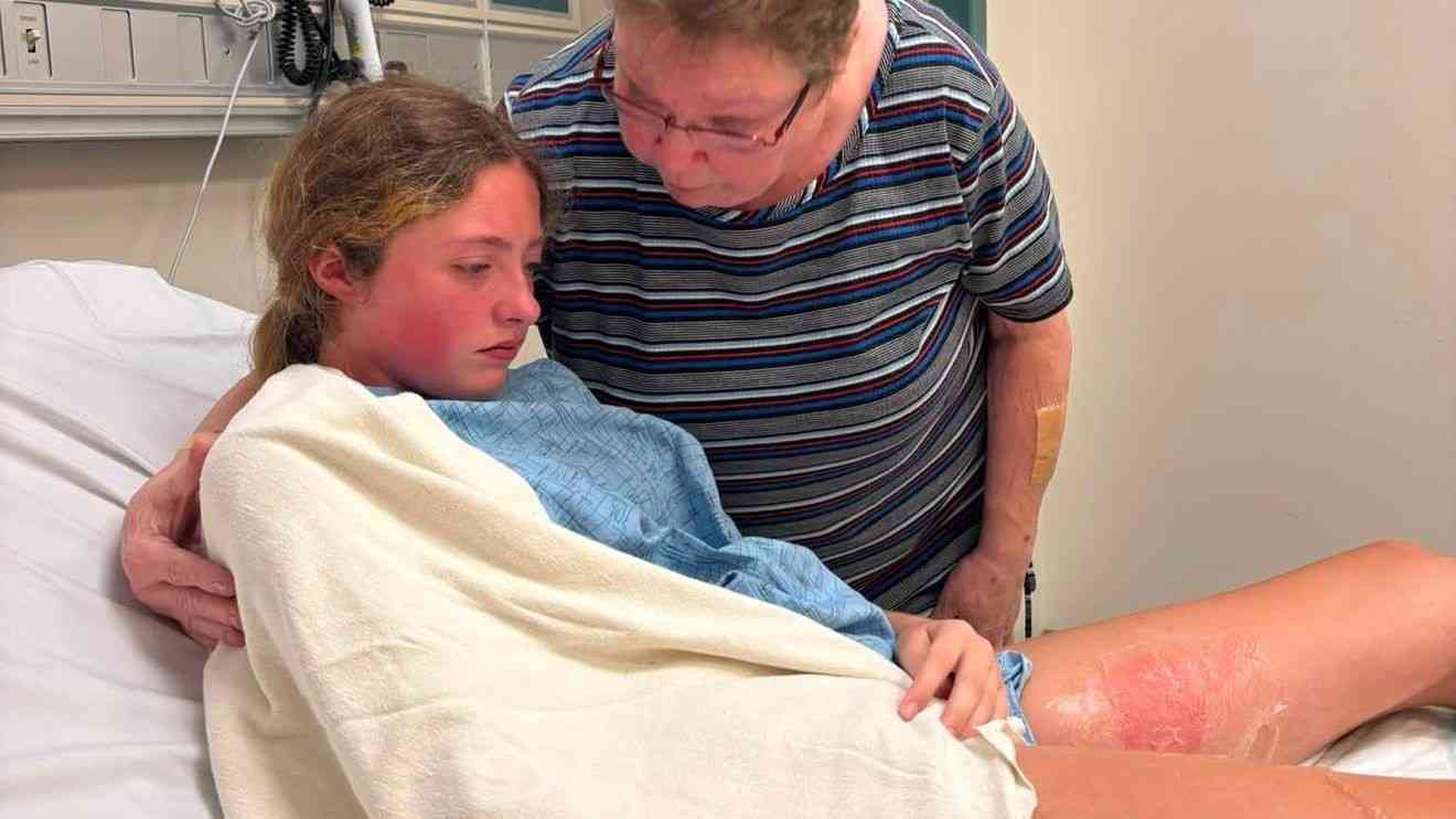 Popular squishy toy sends teen to hospital with burns, what parents should know