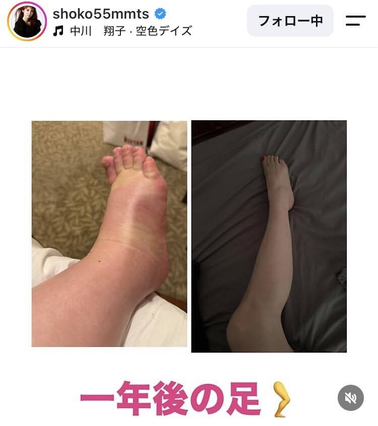 「30キロ以上おちた!」中川翔子、双子出産から1年…ダイエットで驚がくの激変姿!現在の体重も公表「すごすぎ」