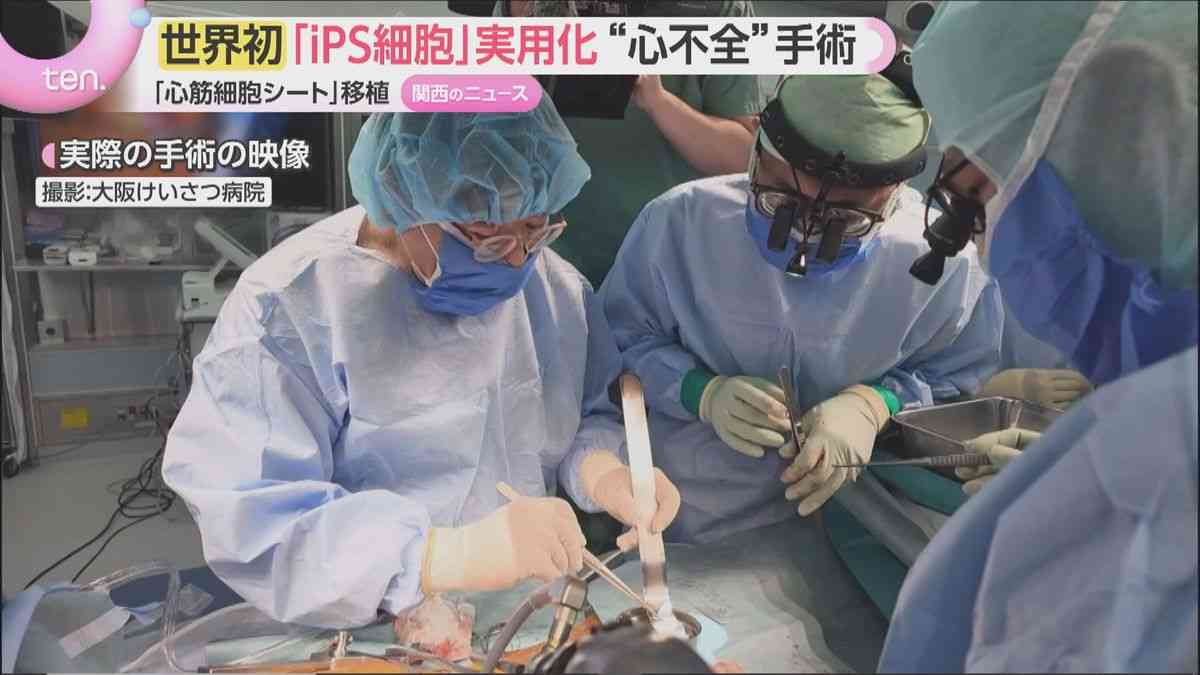 【世界初の実用化】iPS細胞で作った心筋シート「リハート」心不全患者に移植「順調に手術できた」（2026年9月29日掲載）｜YTV NEWS NNN